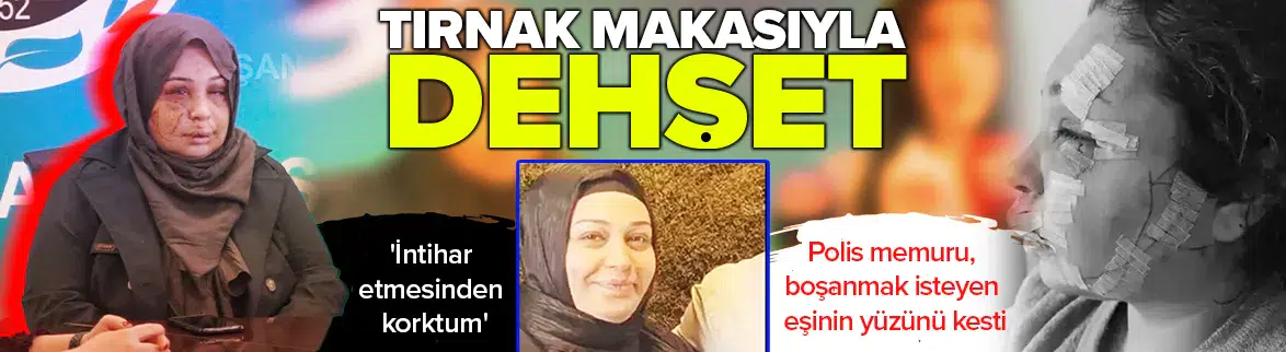 Boşanmak isteyen eşinin yüzünü tırnak makasıyla yaraladı !