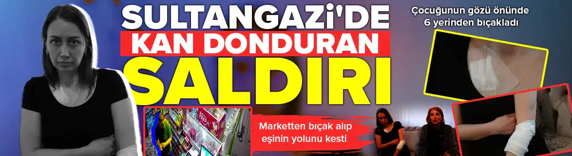 Sultangazi'de kan donduran saldırı