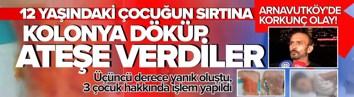 Arnavutköy'de Korkunç Olay: Sırtına Kolonya Dökülüp Ateşe Verildi