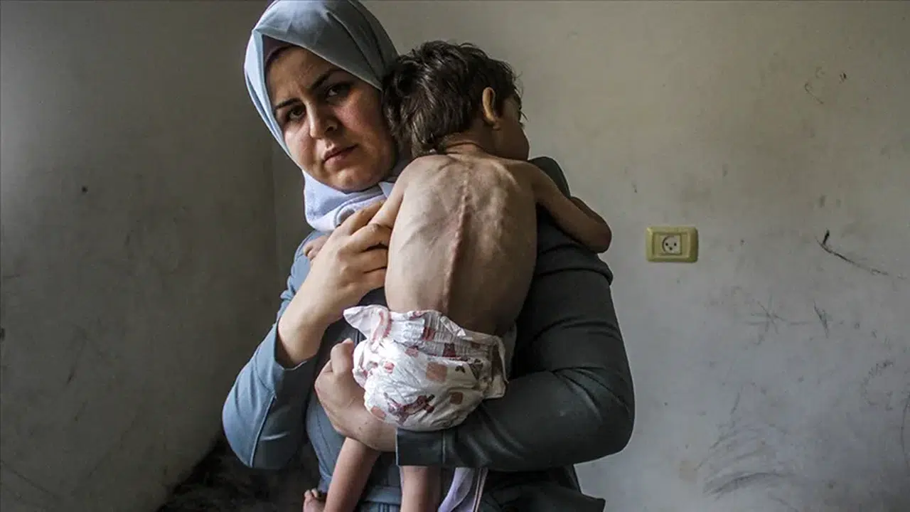 İsrail ablukasındaki Gazze'de 60 çocuk yetersiz beslenmeden hayatını kaybetti