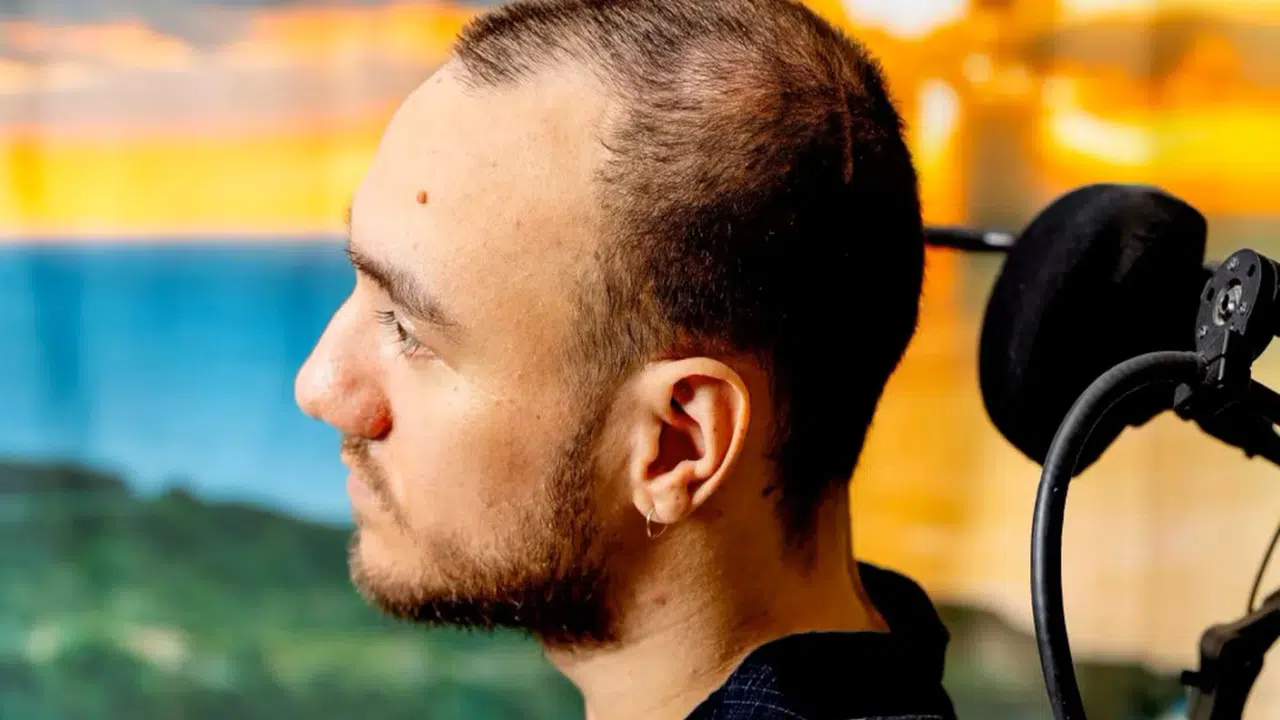 Elon Musk’ın beyin çipi deneyinde skandal! Kontrolü kaybetti