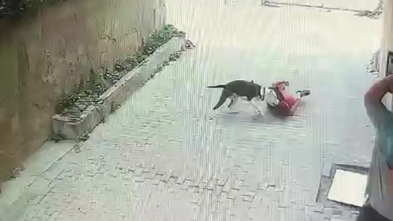 İstanbul’da pitbull saldırısı: 7 yaşındaki çocuk yaralandı