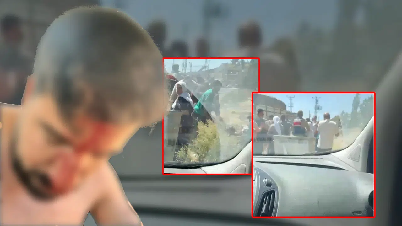 Şırnak’ta kaçak elektrik denetimi yapan personele linç girişimi! DEDAŞ görevlisi ağır yaralandı