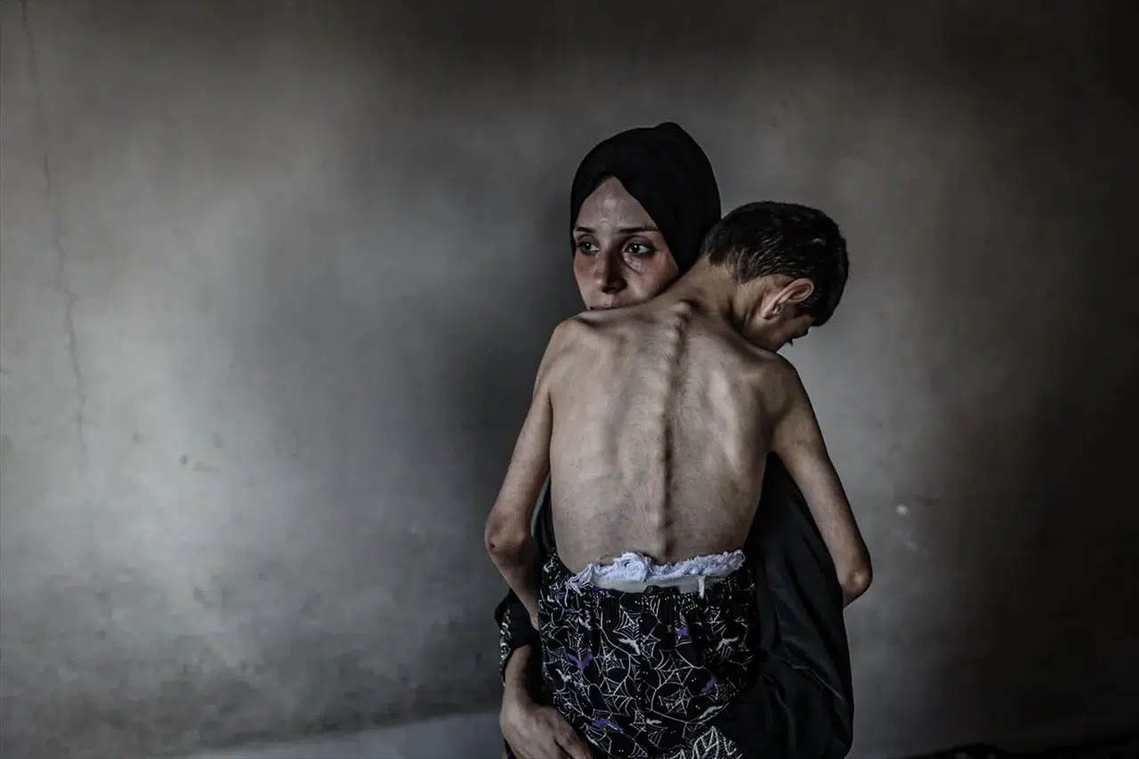 Gazze’de açlıktan ölümler durmuyor: Son 24 saatte 8 kişi daha yaşamını yitirdi
