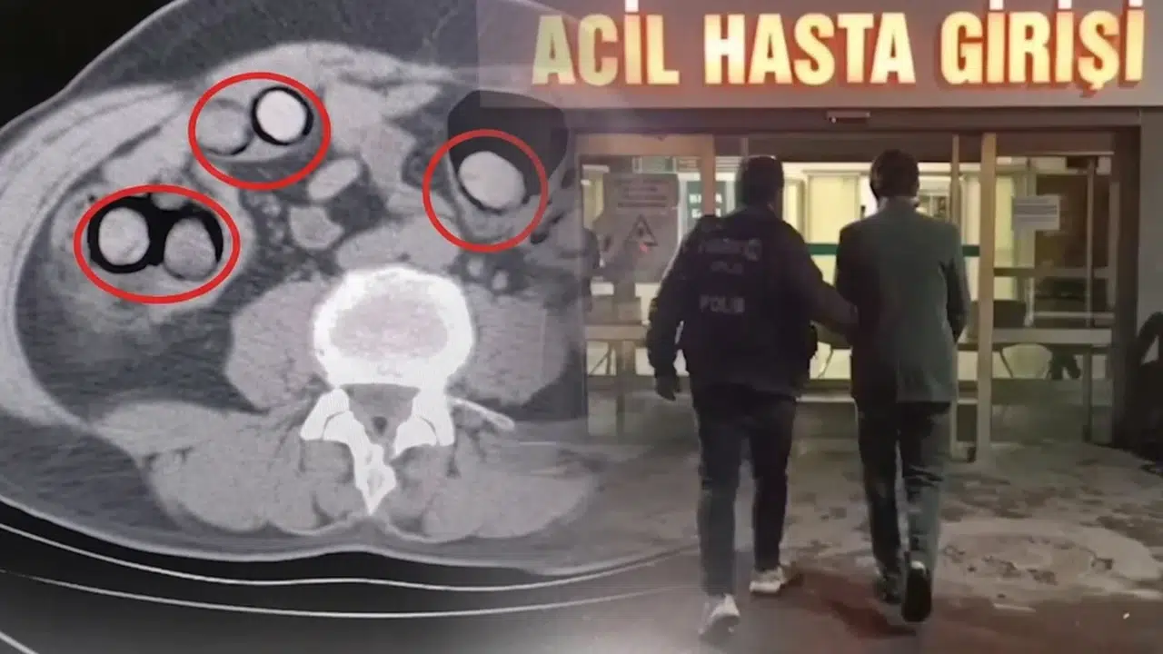 Bitlis'te Yolcu Otobüsünde Midesinden 758 Gram Metamfetamin Çıktı