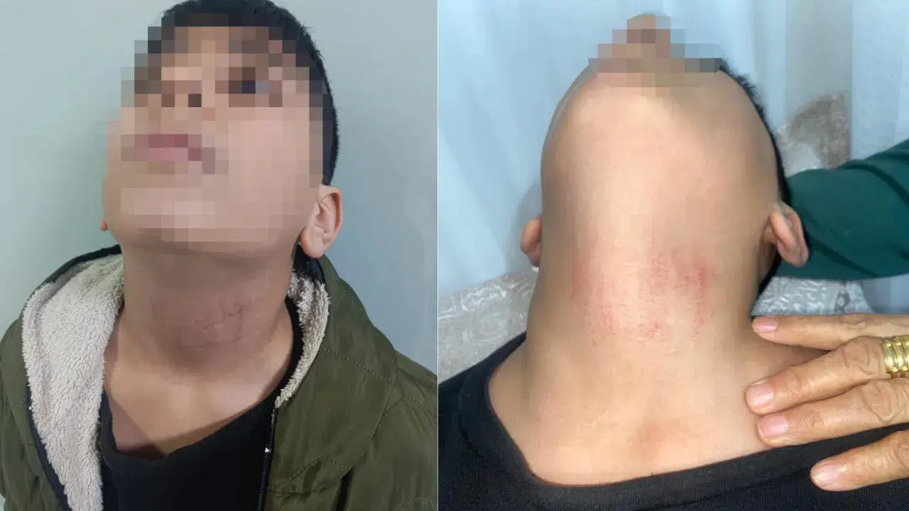 Küçükçekmece'de kadın memurun, ortaokul öğrencisini darbettiği iddiası