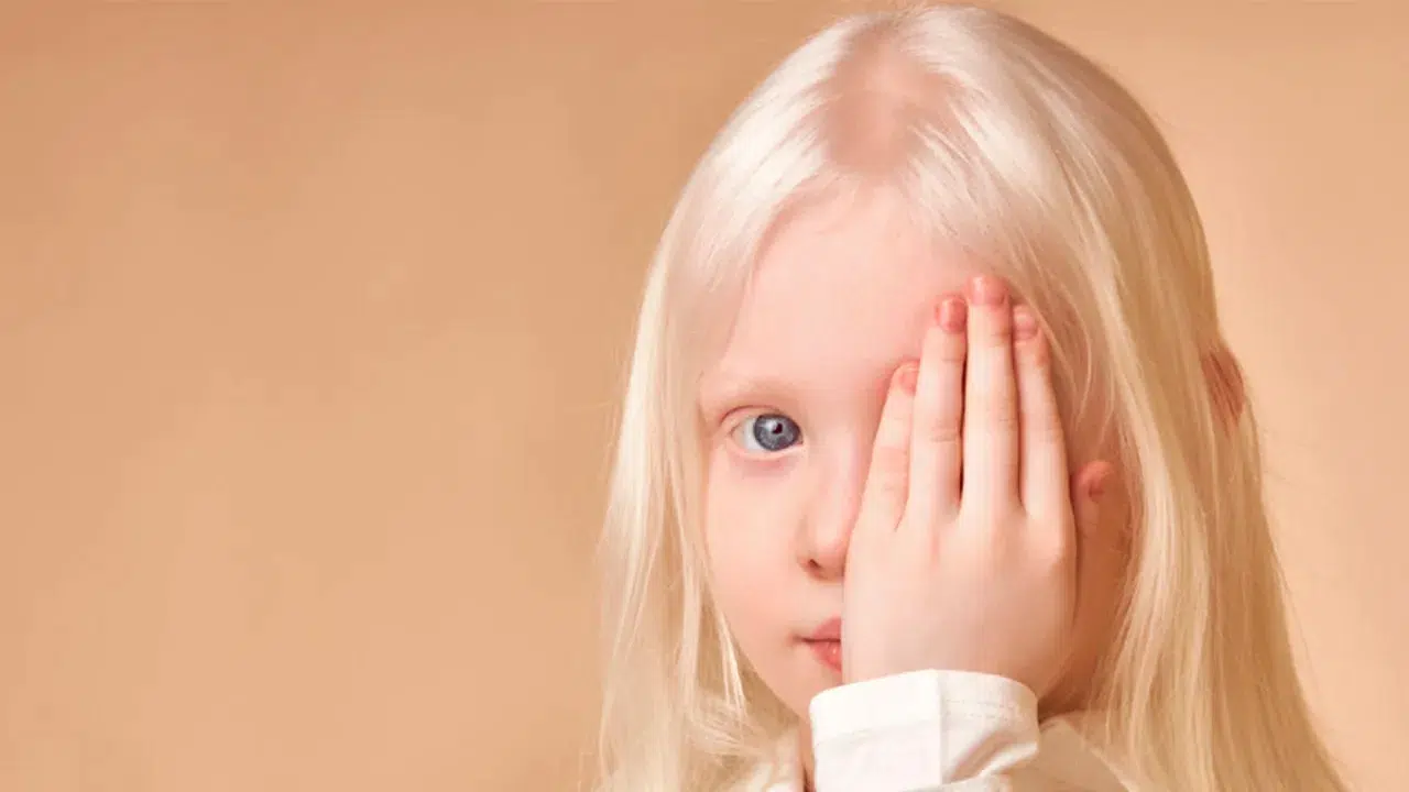 28 Şubat Dünya Nadir Hastalıklar Günü : DMD Aileleri Derneği'nden kamu destekli fon çağrısı