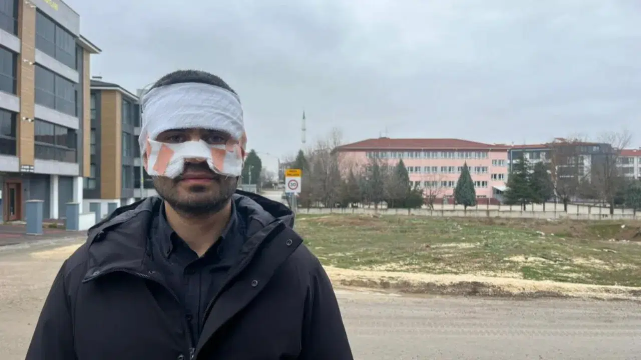 Eskişehir'de bir öğretmen, meslektaşının yüzüne kaynar çay döktü