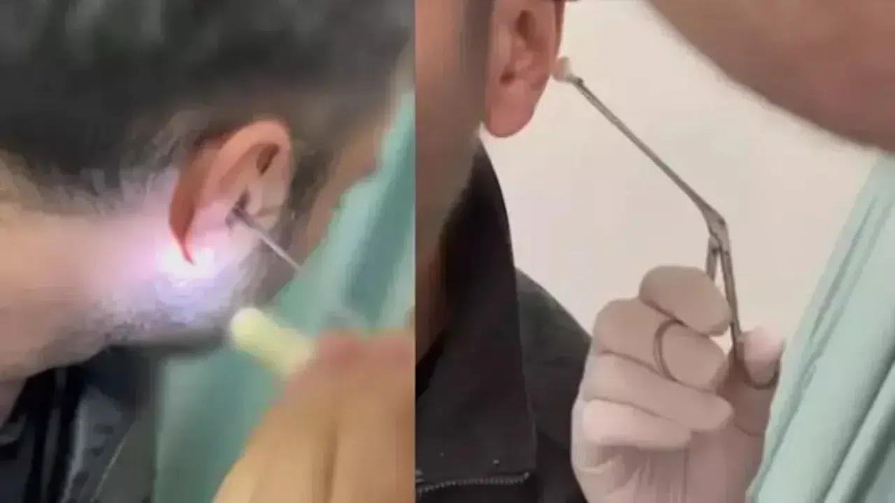 Kayseri'de bir kişi, kulağına gizlediği uyuşturucuyla yakalandı