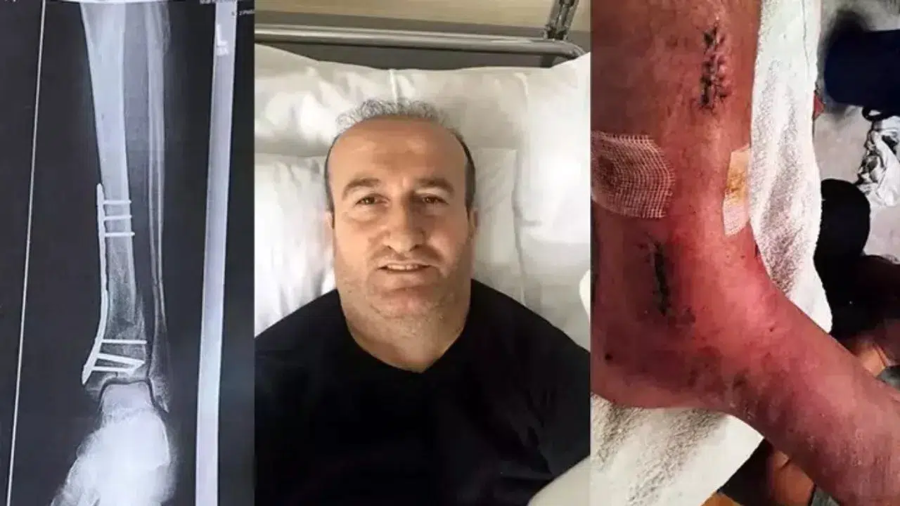 Antalya kazı alanındaki ihmal pahalıya patladı : Turiste 1 milyon liralık tazminat kararı çıktı