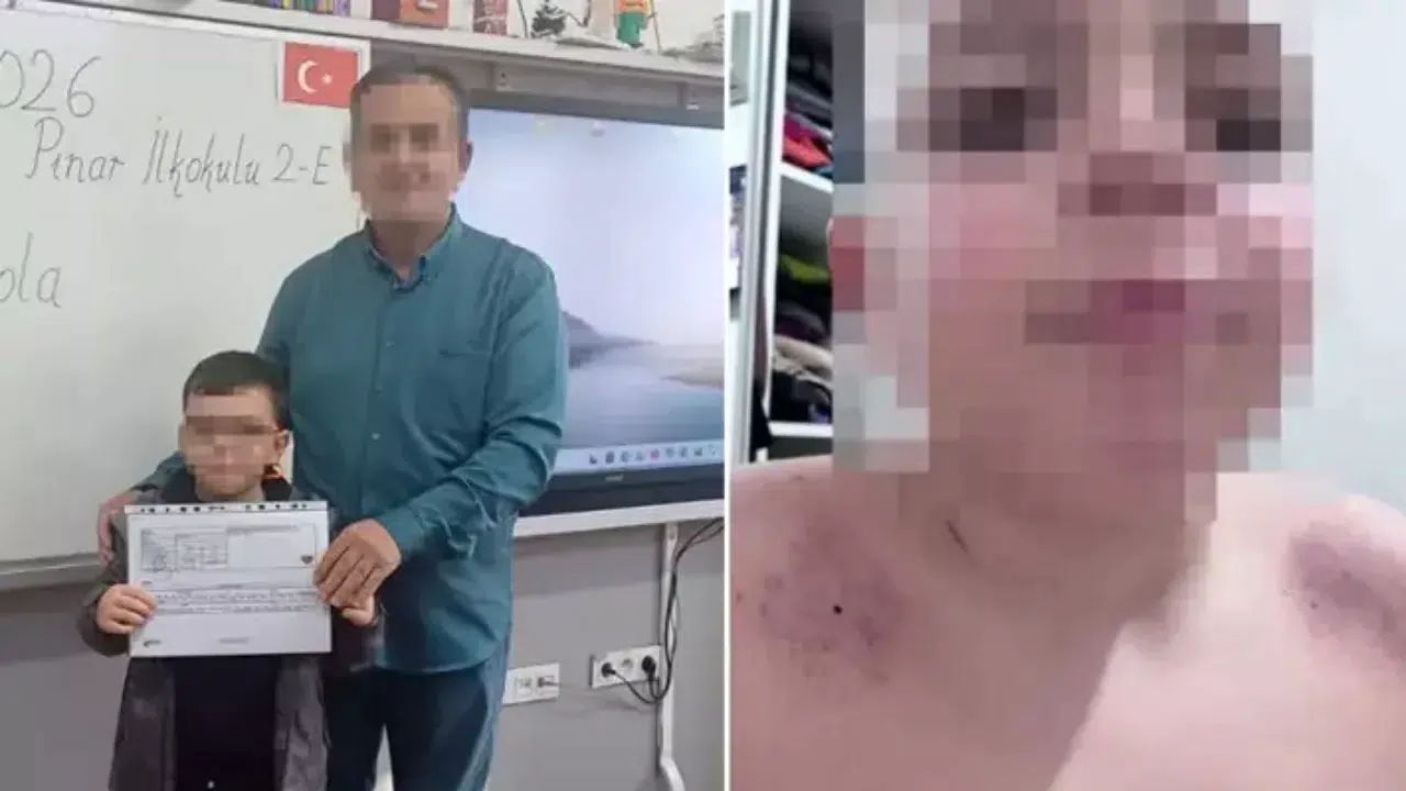 Antalya'da ilkokulda darp iddiası : 'Seni karanlık odaya hapsederim' diyerek omuzlarını morarttı