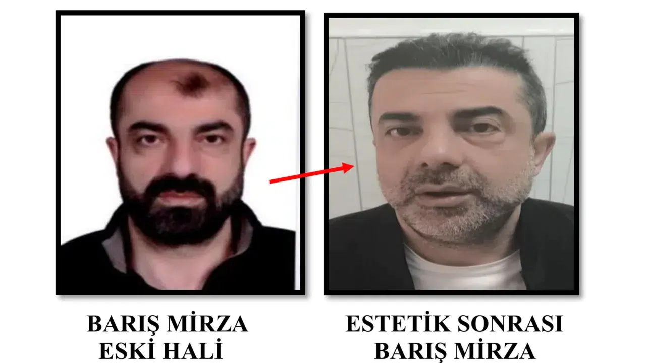 Ankara'da yüzünü ameliyatla değiştiren cinayet zanlısı 7 yıl sonra yakalandı