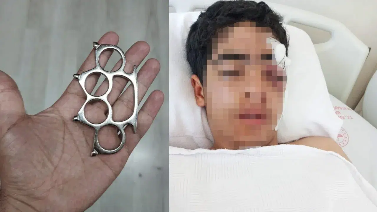 'Bana şaka yapma' dedi, hayatı karardı ! Esenyurt'ta 15 yaşındaki çocuğa muştalı saldırı