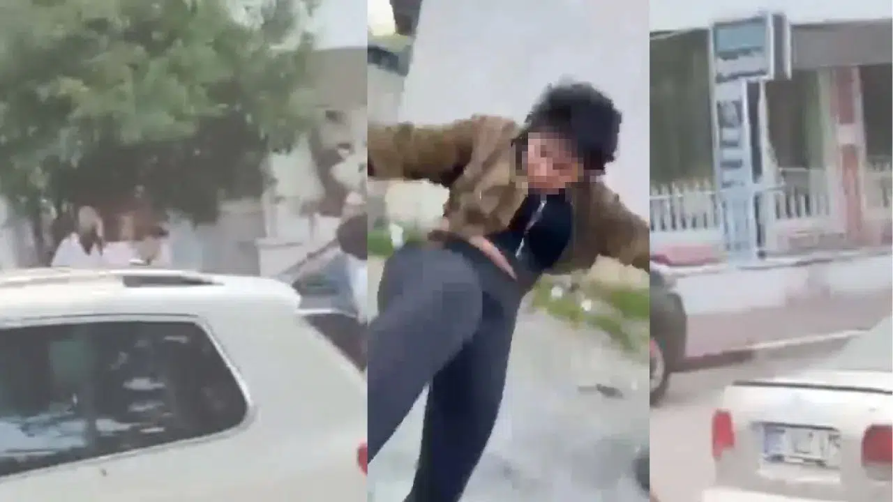 İstanbul Esenyurt'ta bir kadın eski eşini kaskla dövdü