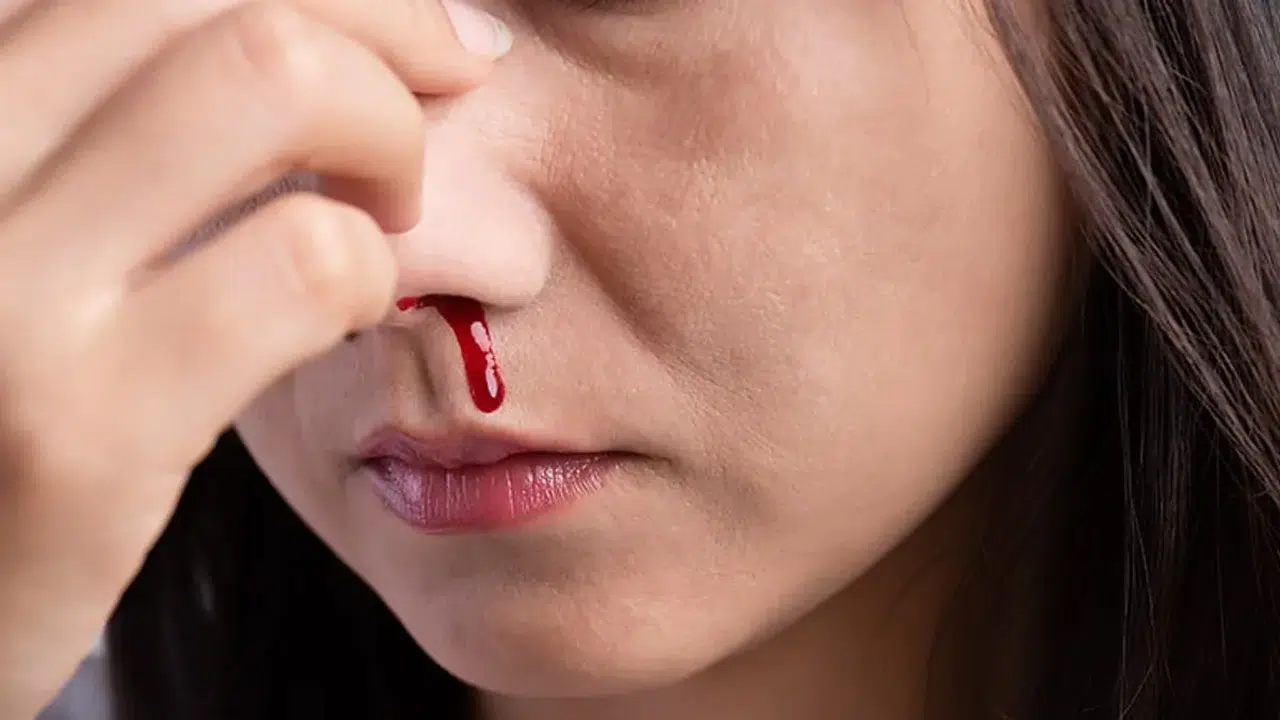 Burun kanaması orucu bozar mı? Diyanet'e göre burundan kan gelince oruç bozulur mu?