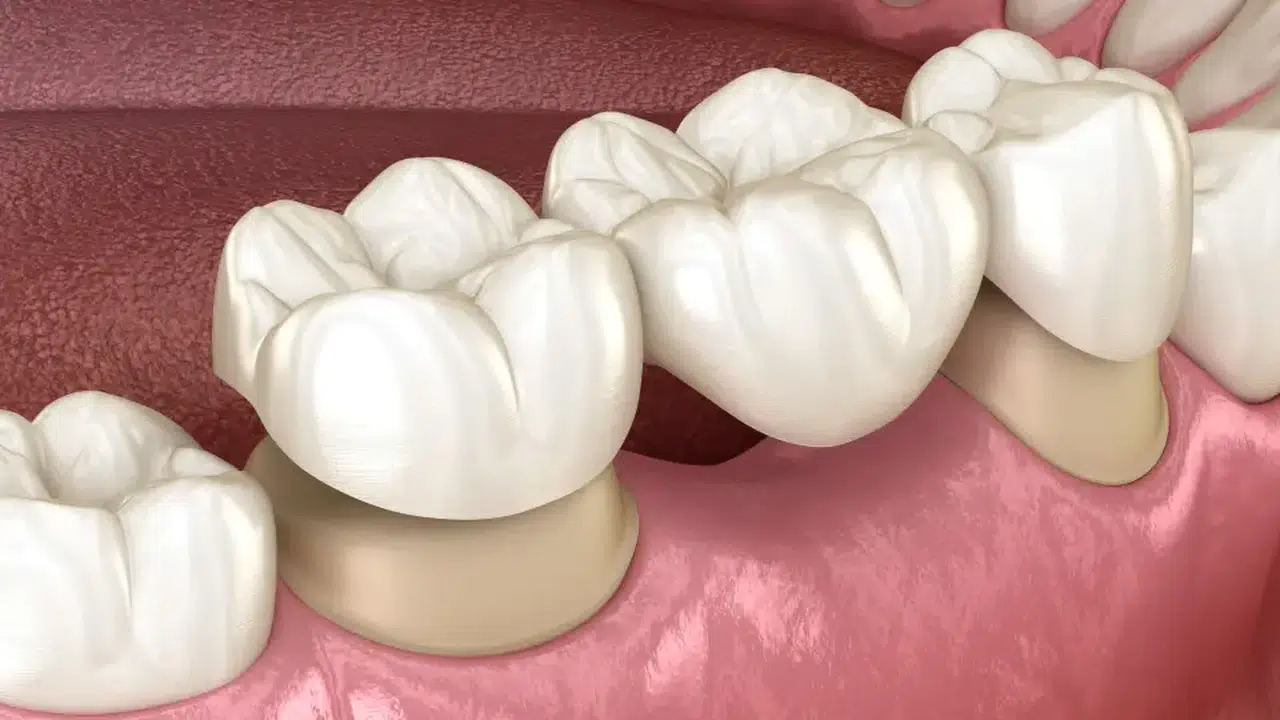 Diş Kaybı Neden Ölüm Riskini Artırıyor? Japonya'da…