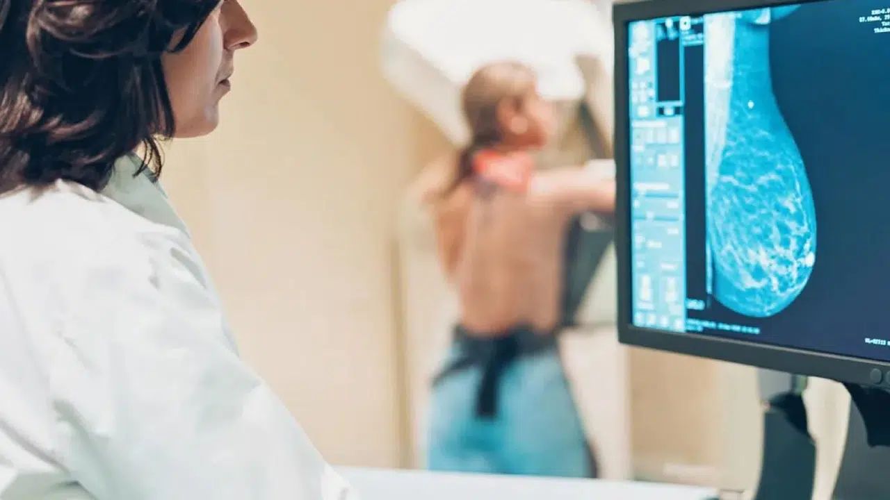 Kadınlarda En Yaygın Kanser Türü Olarak Meme Kanseri, 2050'ye Kadar 3,5 Milyona Ulaşabilir