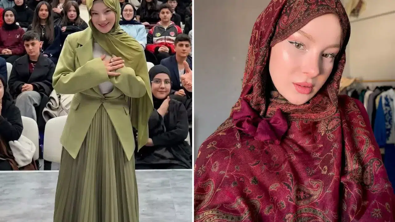Fatma Soydaş'ın Estetiksiz Hali Neden Bu Kadar Dikkat Çekiyor?