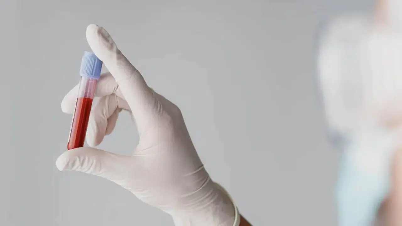 Kan grupları kişiliği nasıl etkiler? Lider mi, özgür ruh mu?