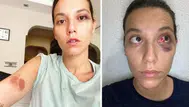 Deniz Bulutsuz olayı nedir, ne zaman yaşandı? Ozan Güven ceza aldı mı?