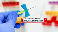 Trigliserit seviyeleri nasıl düşürülür ? Trigliserit nedir ?