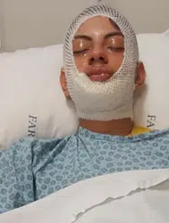 Trabzon'da bir genç ateşe benzin döktü, yaralandı