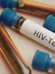 Türkiye'de HIV vakaları artışta : Uzmanlar ileri evre teşhisine karşı uyarıyor