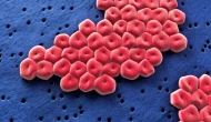 Malezya'da antibiyotik dirençli ölümcül bakteri alarmı!
