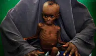 Somali'de açlık krizi derinleşiyor : 6,5 milyon kişi risk altında