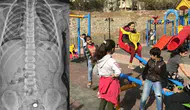Parkta bulduğu pili şeker sanıp yuttu : 4 yaşındaki çocuğun midesi yandı