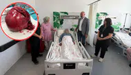 Niğde'de hastanın vücudundaki 7 kiloluk tümör başarıyla çıkarıldı