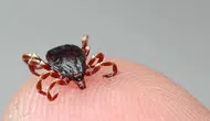 Tokat'ta 5 kişiye KKKA hastalığı teşhisi konuldu