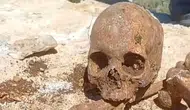 Malatya'da kazı sırasında insan kemikleri ve kafatası parçası bulundu