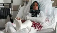 Mersin'de husumetlileri tarafından saldırıya uğran kadının kolu ve bacağı kırıldı