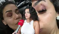Bahçeşehir'de uzaklaştırma kararına rağmen darbedilen kadın : Ölmeden önce sesimi duyun