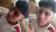 Afyonkarahisar'da öğretmenin kafa attığı 16 yaşındaki çocuğun burnu kırıldı