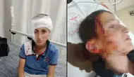 İzmir'de köpek saldırısına uğrayan çocuğa 1,2 milyon TL tazminat kararı