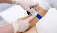 Kan tahlili öncesi açlık şart mı ? Araştırmadan dikkat çeken sonuç