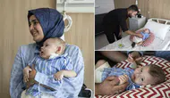 Dünyada sadece 2 bebeğe uygulanmıştı, 3.'sü Türkiye'de yapıldı! 6 aylık Osman bu tedaviyle hayata tutundu