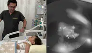Konya'da 1 Yaşındaki Bebeğin Akciğerinden Ceviz Parçası Çıkarıldı