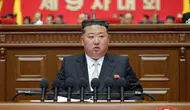 Kim Jong-Un Öldü Mü, Yaşıyor Mu? Beyin Kanaması İddiaları
