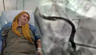 Zatürre Kaynaklı Şiddetli Öksürük Kalp Damarını Yırttı