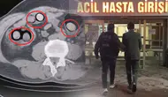 Bitlis'te Yolcu Otobüsünde Midesinden 758 Gram Metamfetamin Çıktı