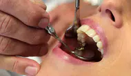 Dişlerimizde gözükmeyen tehlikeler neler? Sağlığımız için neden bu kadar önemliler?
