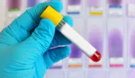 Alzheimer riskini öngören yeni bir kan testi yolda! Tam olarak ne zaman hazır olacak?
