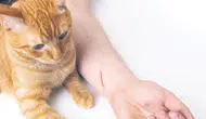 Kedi , köpek ısırıkları ve çiziklerinde dikkat edilmesi gerekenler neler?