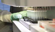 Yeni ultrason teknolojisi ile en agresif beyin tümörü nasıl canlı olarak izlenebilir ?