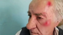 Köpeklerin saldırısına uğrayan yaşlı adam hastaneye kaldırıldı