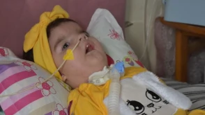 SMA hastaları için yeni müjde
