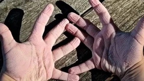 Suya girince parmaklar neden buruşuyor? Bilim insanları şaşırtıcı nedeni açıkladı!